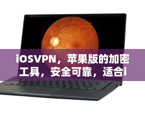 iOSVPN，苹果版的加密工具，安全可靠，适合iOS用户
