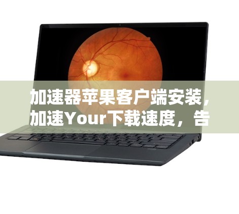 加速器苹果客户端安装，加速Your下载速度，告别等待